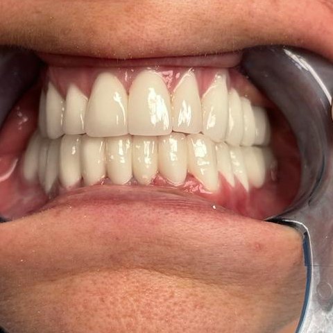 Vividenta - Vividenta