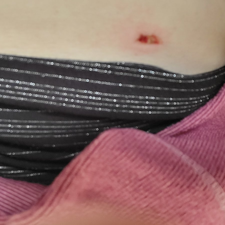 Walsall Skin Clinic - Walsall Skin Clinic