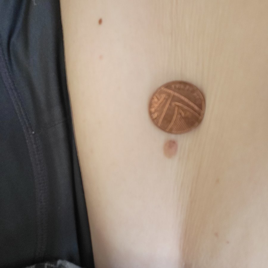 Walsall Skin Clinic - Walsall Skin Clinic