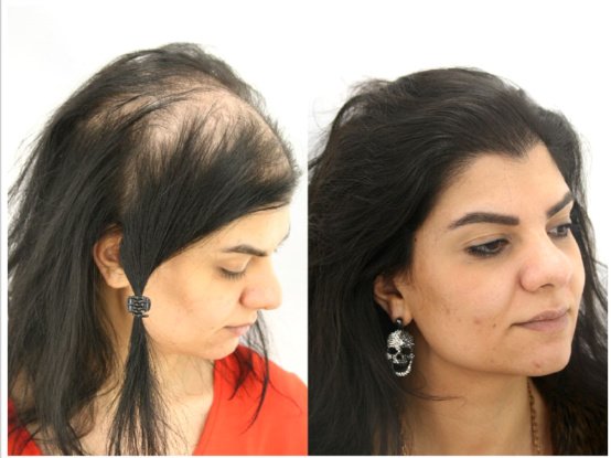 Want Hair - Want Hair