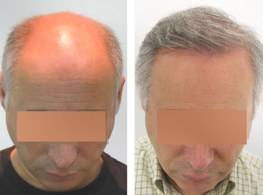 Want Hair - Want Hair