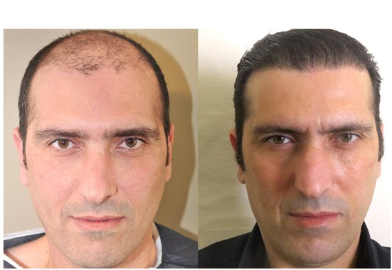 Want Hair - Want Hair