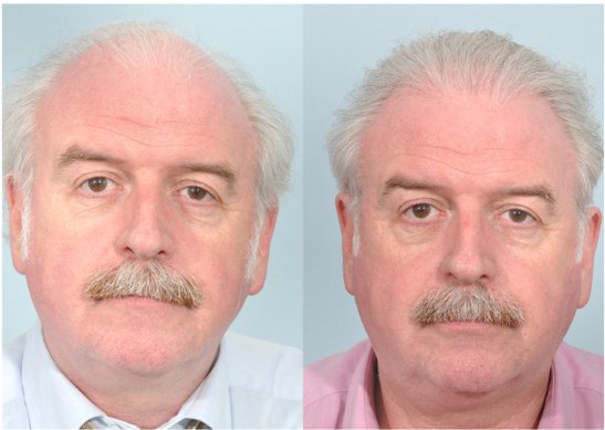 Want Hair - Want Hair