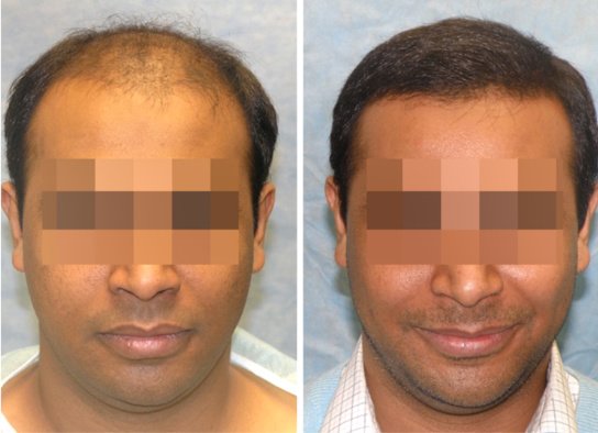 Want Hair - Want Hair