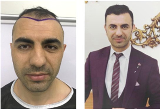 Want Hair - Want Hair