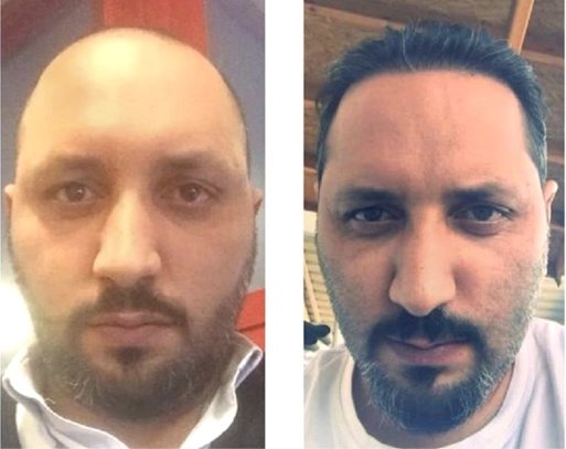 Want Hair - Want Hair