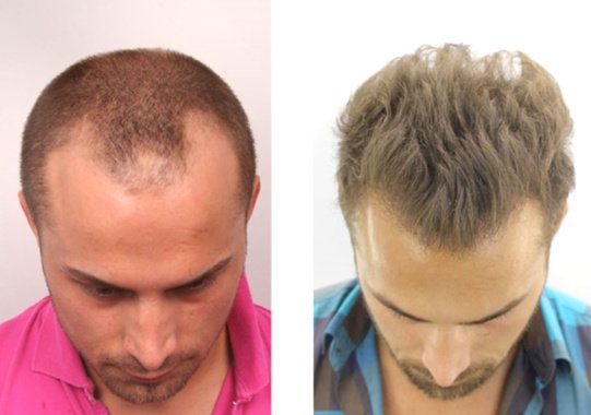 Want Hair - Want Hair