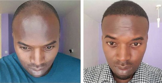 Want Hair - Want Hair