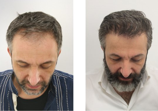 Want Hair - Want Hair