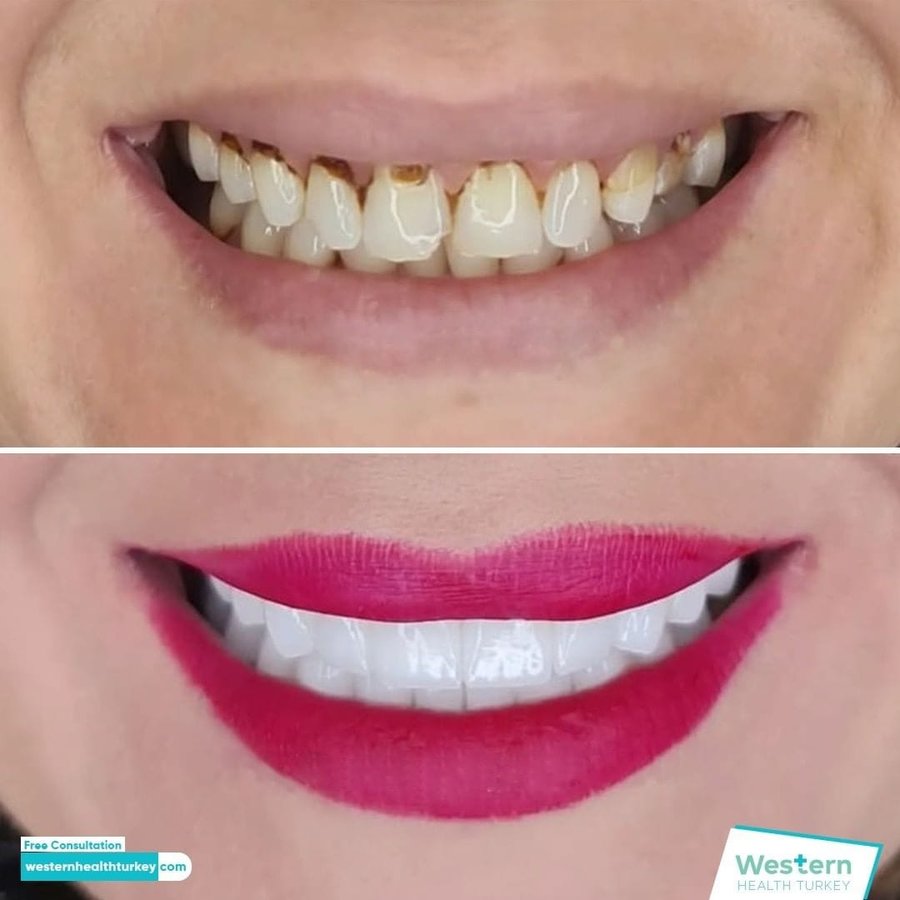 Western Health Turkey - Western Health Turkey