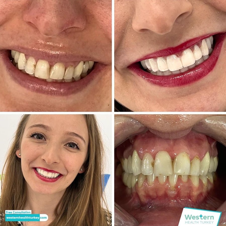 Western Health Turkey - Western Health Turkey