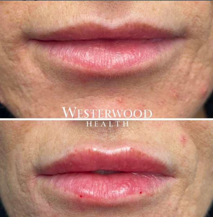 ويستروود هيلث - Westerwood Health