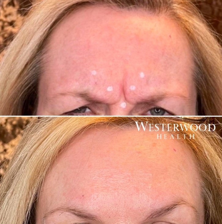 ويستروود هيلث - Westerwood Health