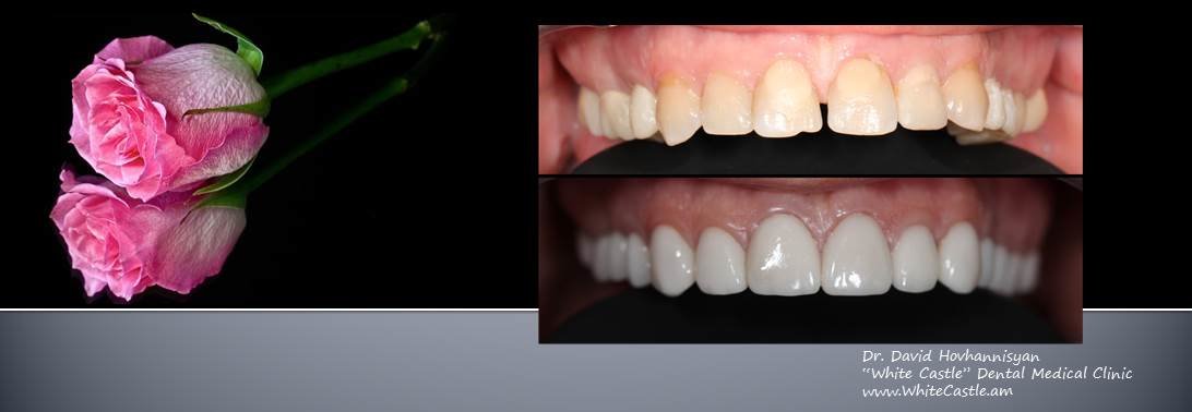 "القلعة البيضاء" عيادة طب الأسنان - "White Castle" Dental Medical Clinic