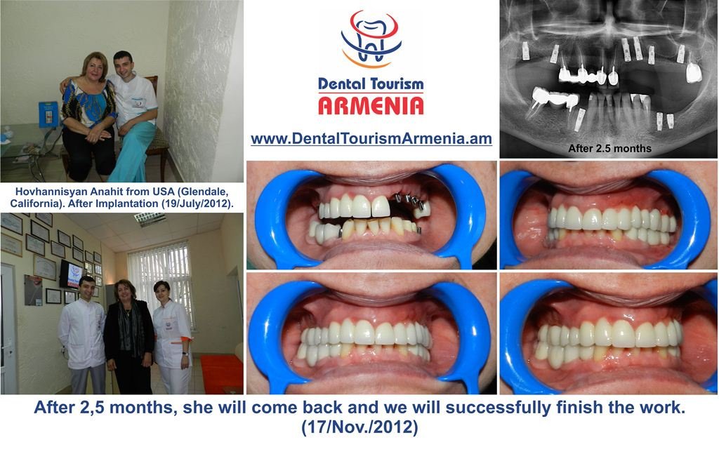 "القلعة البيضاء" عيادة طب الأسنان - "White Castle" Dental Medical Clinic