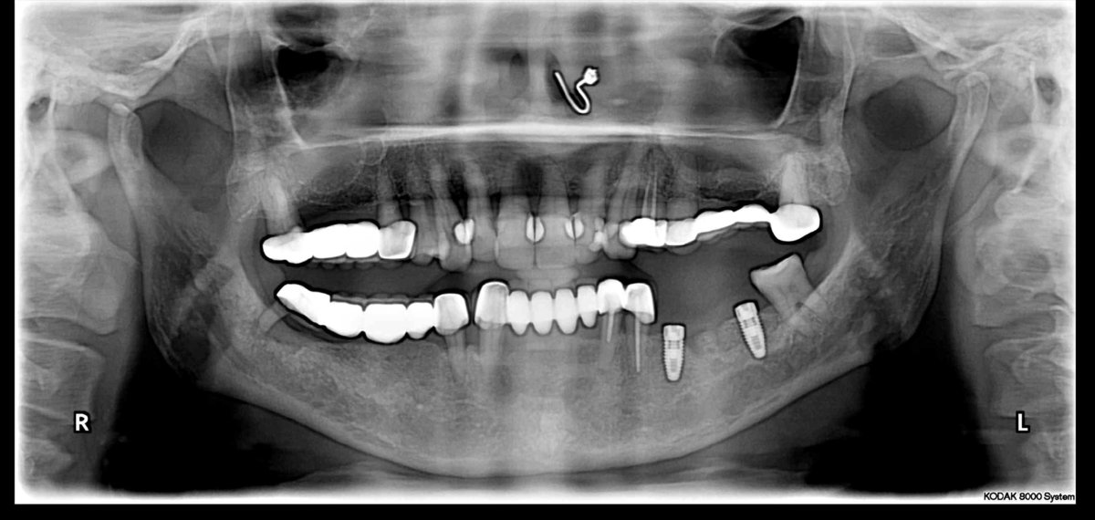 مستشفى وايت كاستلز للأسنان - WHITE CASTLES DENTAL HOSPITAL