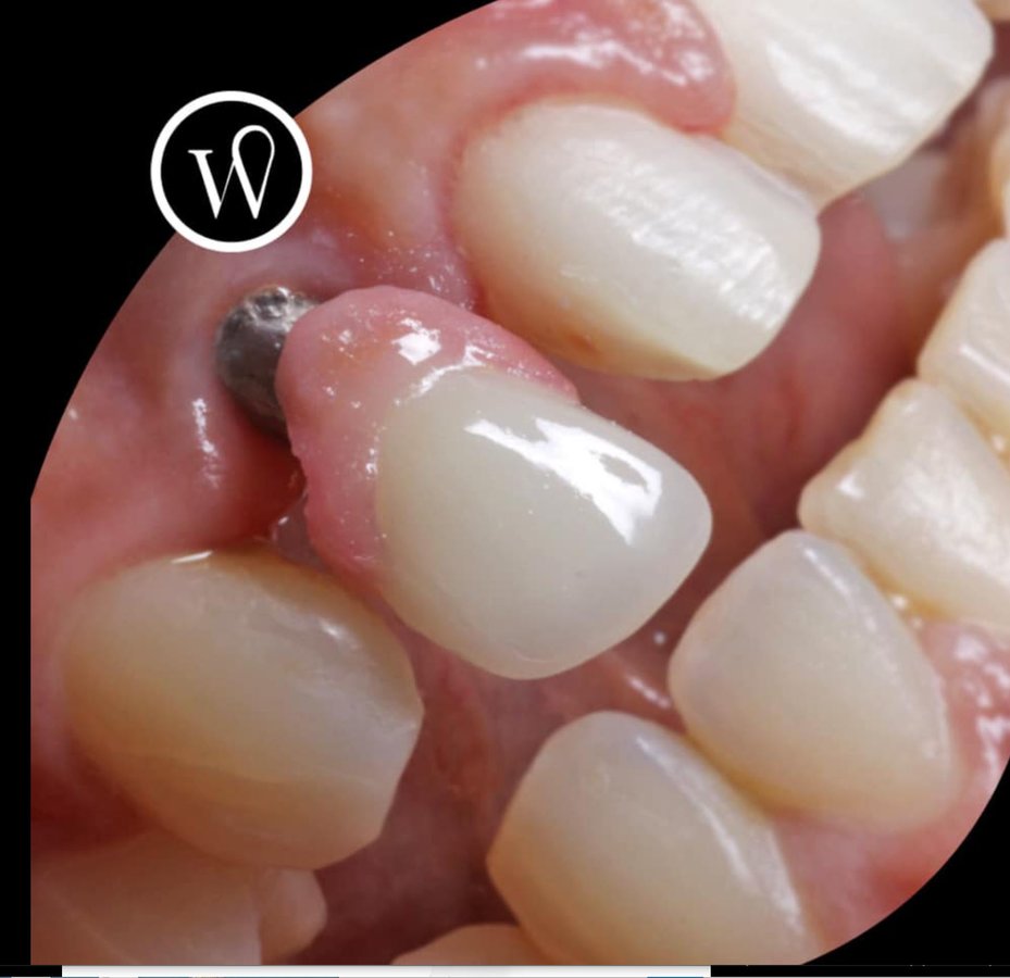 White Coast - Dr. Juan Carlos Luevano - White Coast - Dr. Juan Carlos Luevano