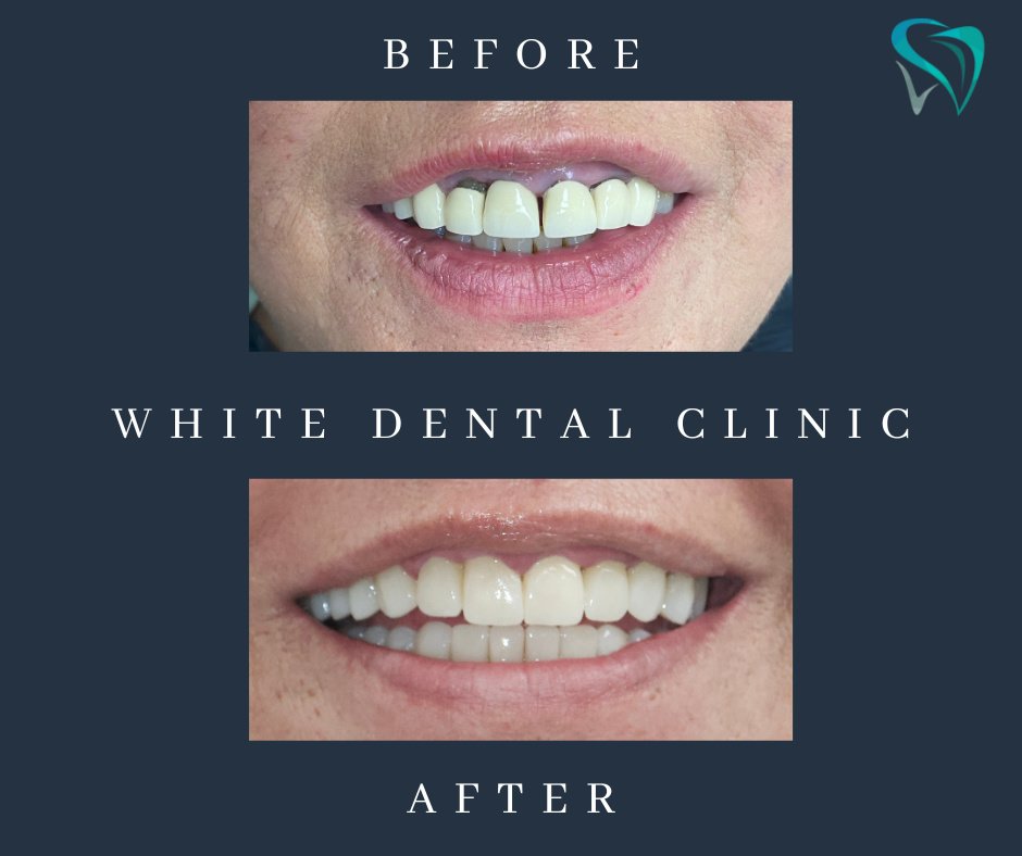 White Dental Clínica Dental - White Dental Clínica Dental