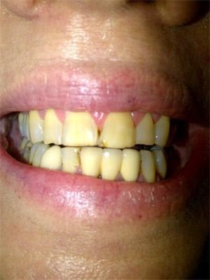 White Smiles Studio - White Smiles Studio