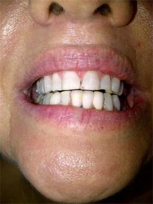 White Smiles Studio - White Smiles Studio