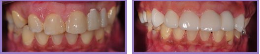 Wichita Family Dental - Wichita Family Dental