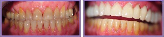 Wichita Family Dental - Wichita Family Dental