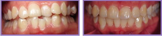 Wichita Family Dental - Wichita Family Dental