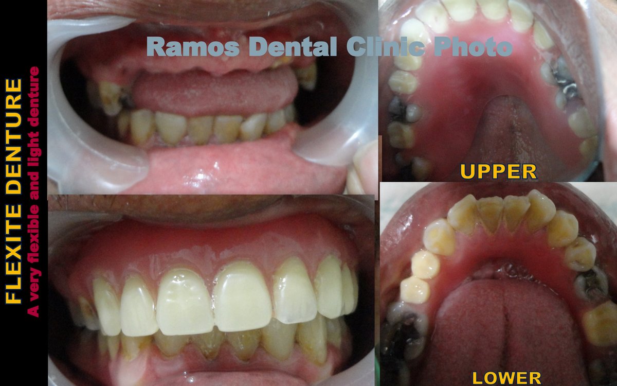 Winsome Smile Today - Winsome Smile Today