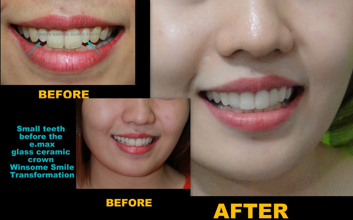 Winsome Smile Today - Winsome Smile Today