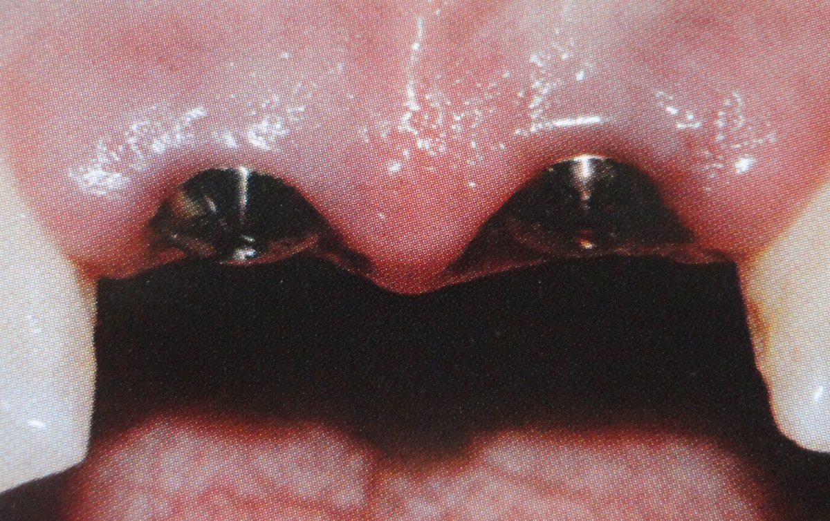 Winsome Smile Today - Winsome Smile Today