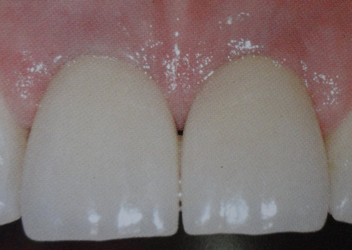 Winsome Smile Today - Winsome Smile Today