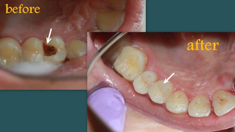 Winsome Smile Today - Winsome Smile Today