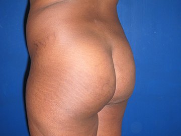 WISH Aesthetic Surgery Clinic - WISH Aesthetic Surgery Clinic