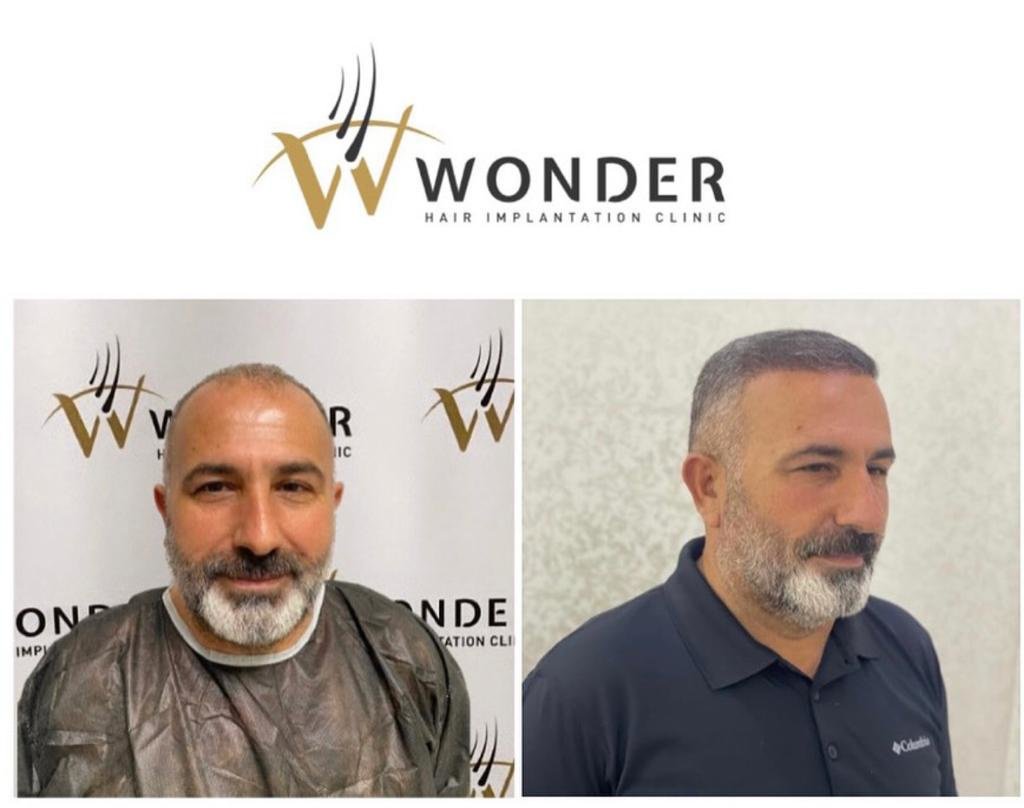 Wonder Hair Clinic - Wonder Hair Clinic