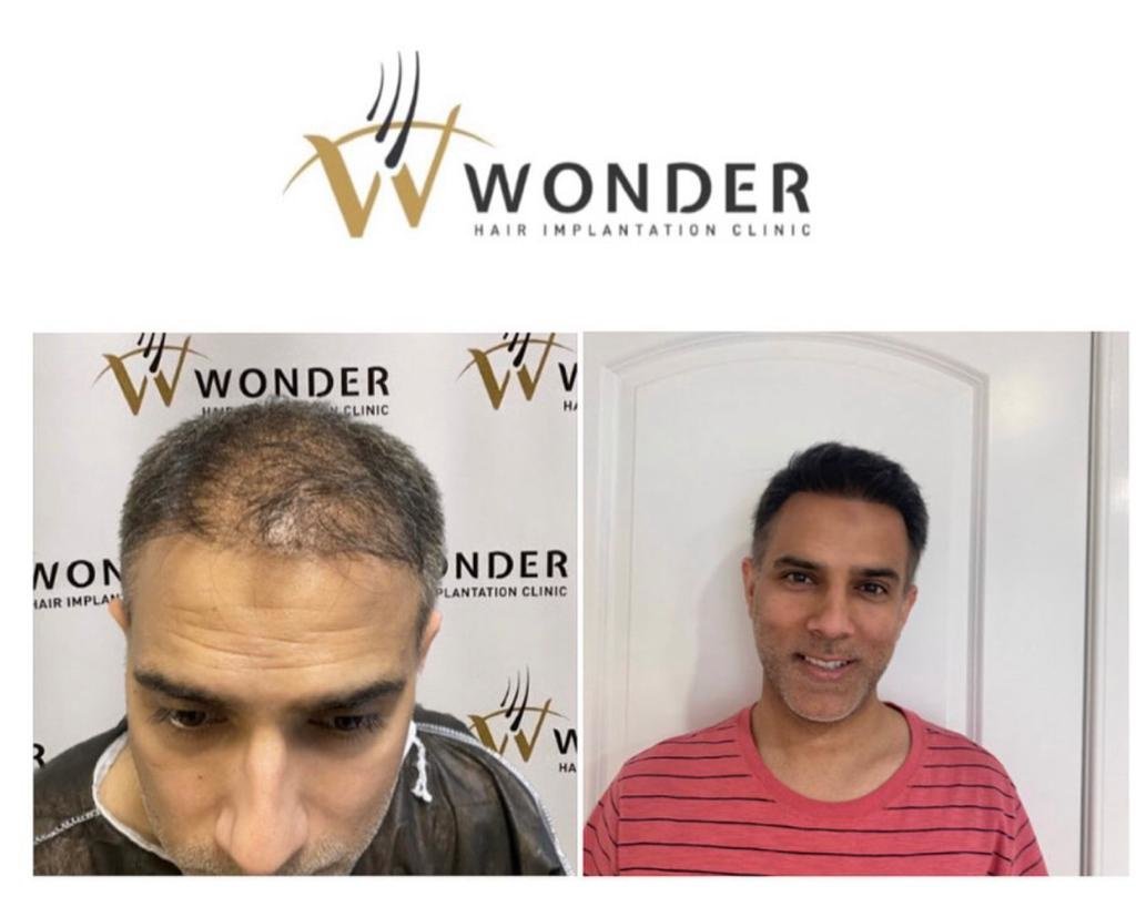 Wonder Hair Clinic - Wonder Hair Clinic