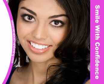 WOW الليزر تبييض الأسنان ليدز - WOW Laser Teeth Whitening Leeds