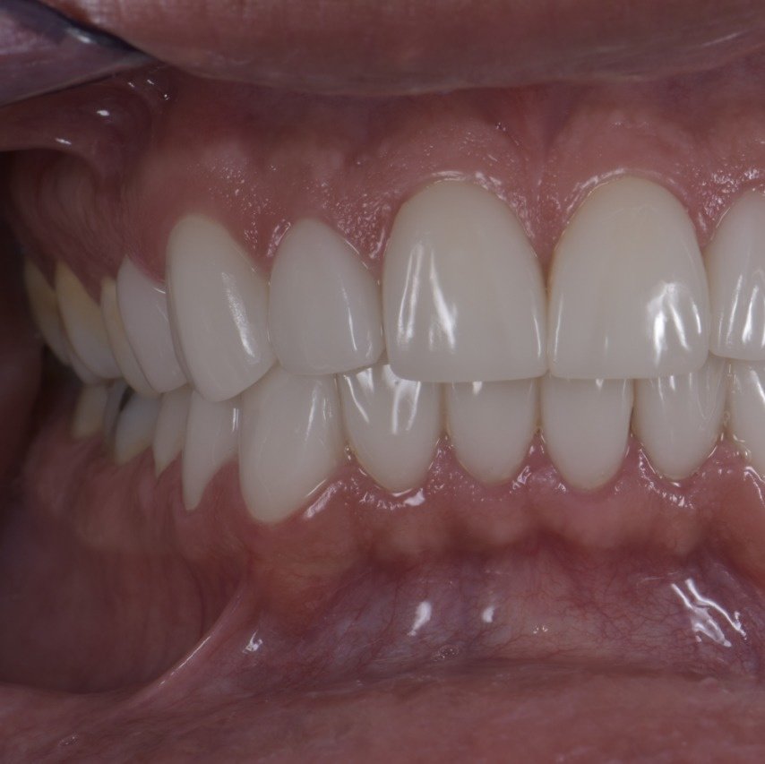 X Dentistry Tijuana - X Dentistry Tijuana