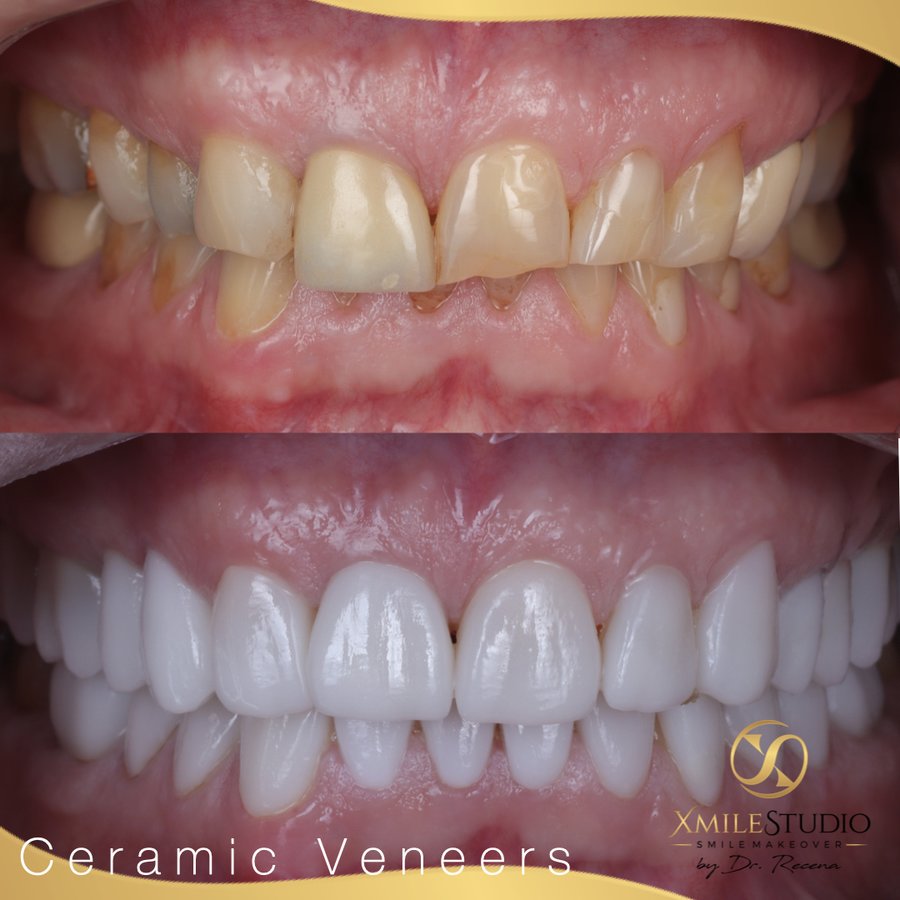 Xmile Studio Dental Clinic - Xmile Studio Dental Clinic