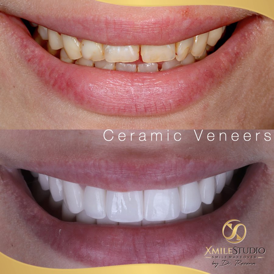 Xmile Studio Dental Clinic - Xmile Studio Dental Clinic