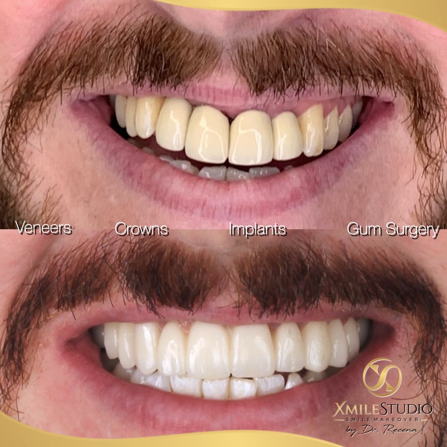 Xmile Studio Dental Clinic - Xmile Studio Dental Clinic