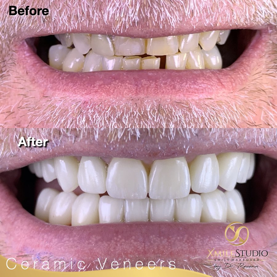 Xmile Studio Dental Clinic - Xmile Studio Dental Clinic