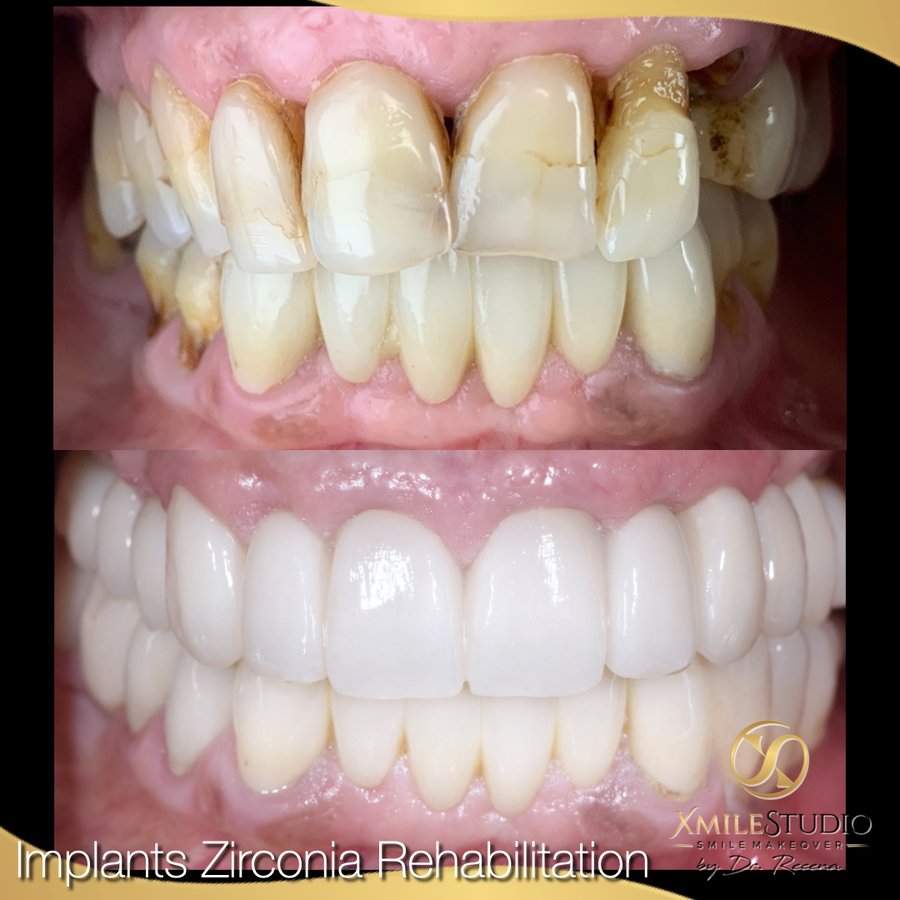Xmile Studio Dental Clinic - Xmile Studio Dental Clinic