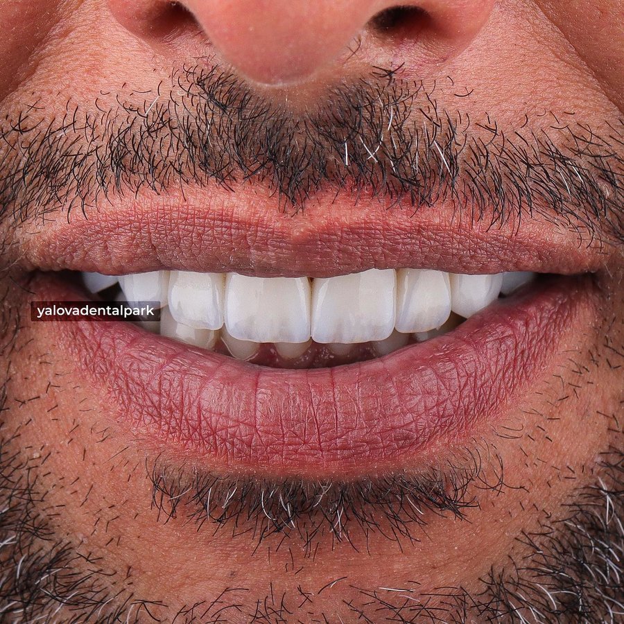 YALOVA DENTALPARK - YALOVA DENTALPARK