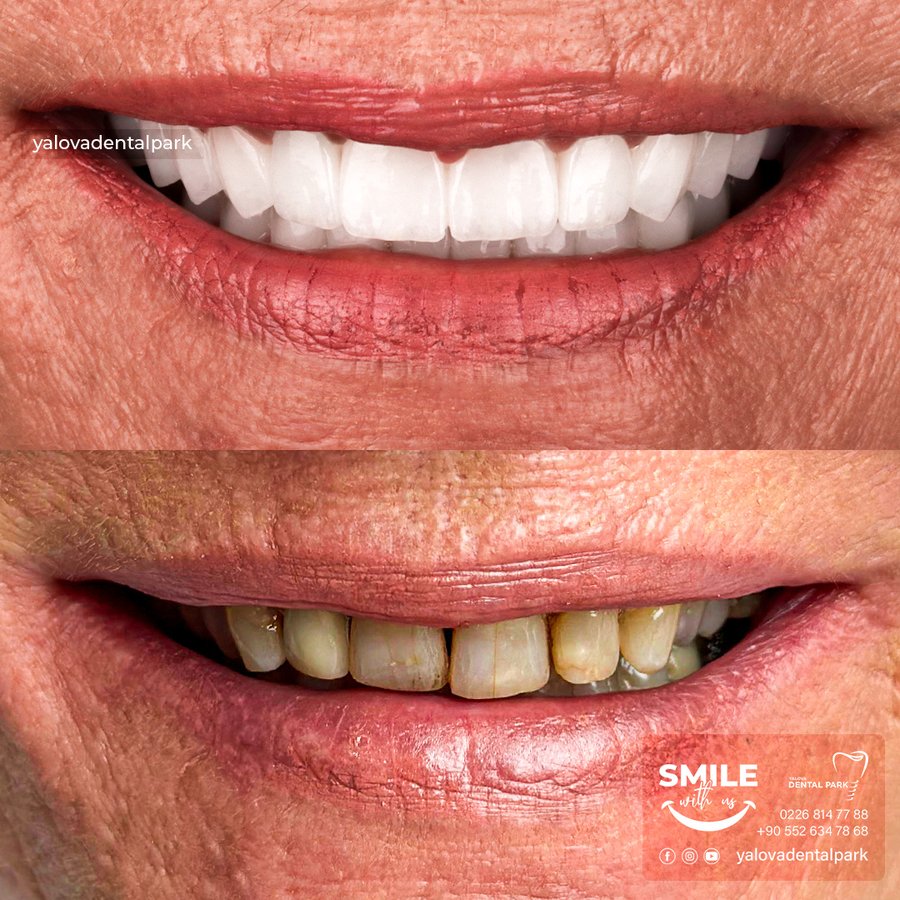 YALOVA DENTALPARK - YALOVA DENTALPARK
