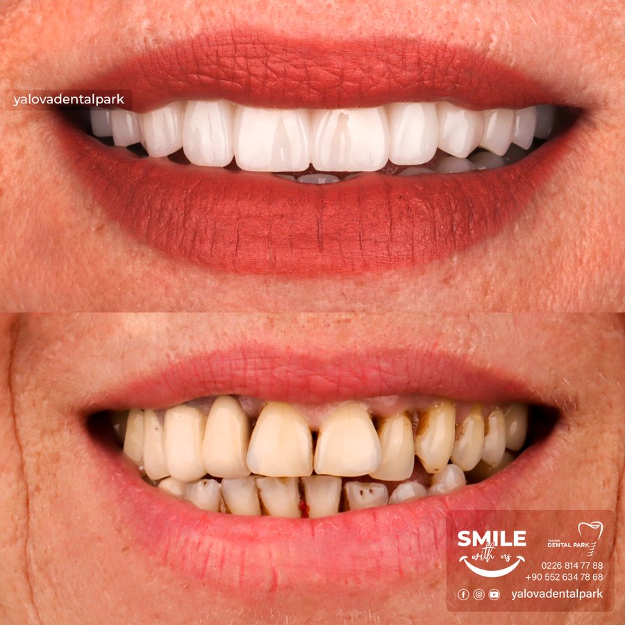 YALOVA DENTALPARK - YALOVA DENTALPARK
