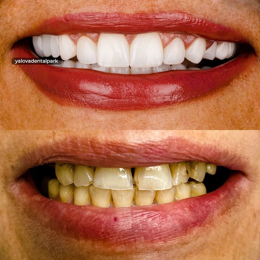 YALOVA DENTALPARK - YALOVA DENTALPARK