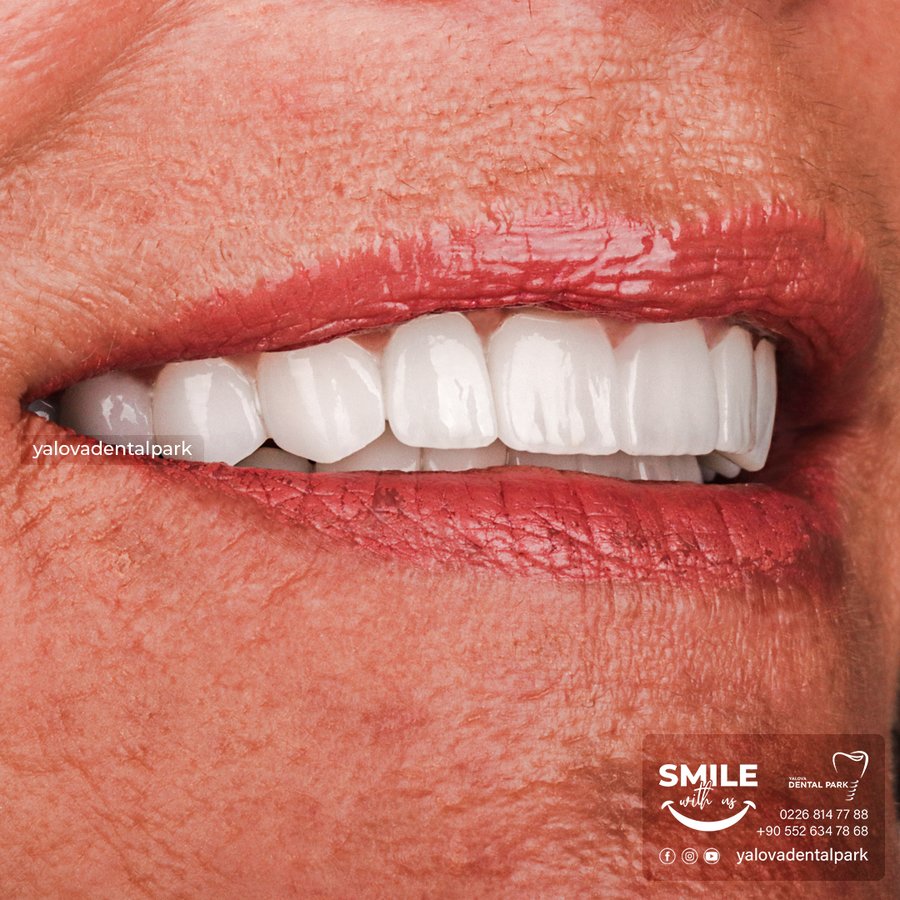 YALOVA DENTALPARK - YALOVA DENTALPARK