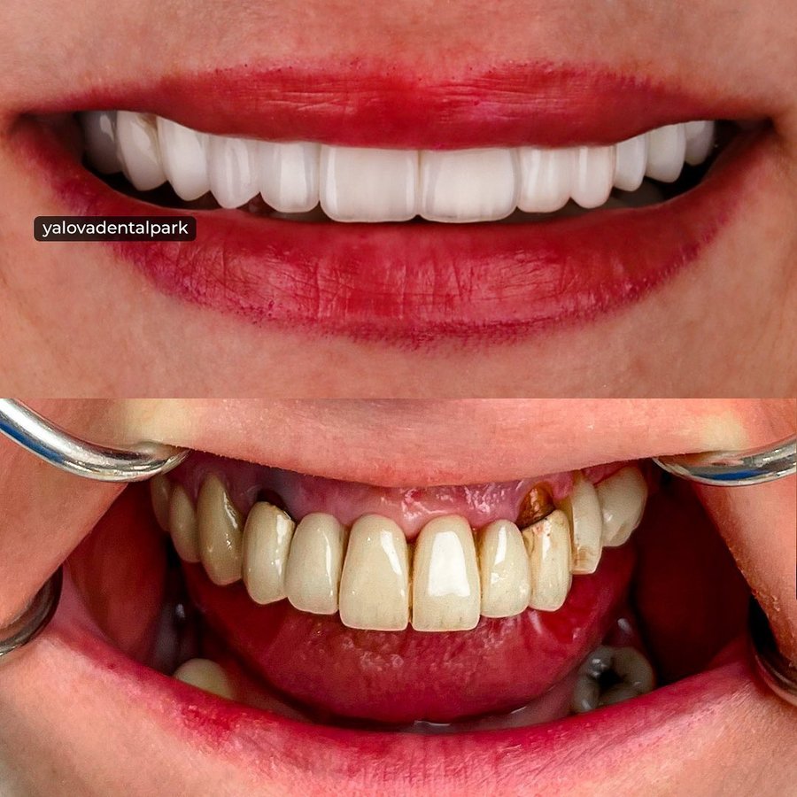 YALOVA DENTALPARK - YALOVA DENTALPARK