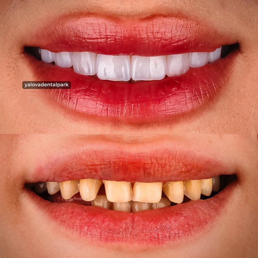 YALOVA DENTALPARK - YALOVA DENTALPARK