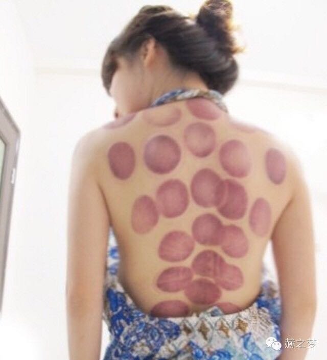 Yang Sheng Japanese Treatment Centre - Yang Sheng Japanese Treatment Centre